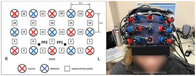 A pediatric near-infrared spectroscopy brain-computer interface based on the detection of emotional valence